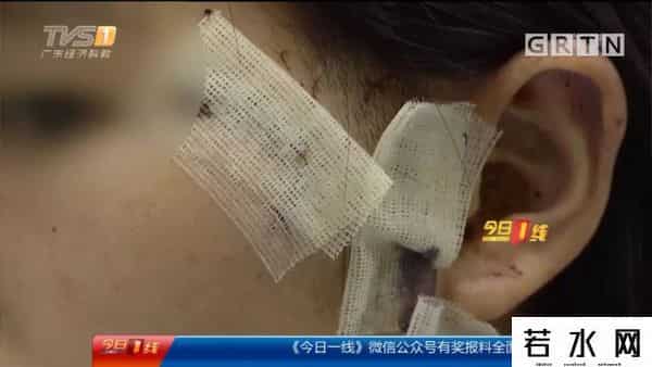 求爱不成毁容