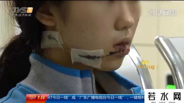 求爱不成毁容