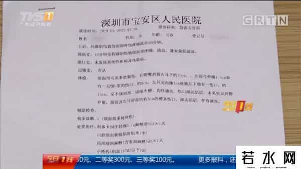 求爱不成毁容