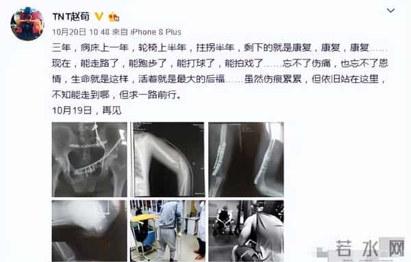 明明名气不低，却还是受尽委屈，再次受伤的成毅，还是太体面了