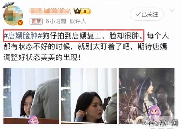 葬礼五天后唐嫣复工，法令纹凹陷状态憔悴，脸肿成发面馒头不敢认