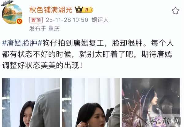 葬礼五天后唐嫣复工，法令纹凹陷状态憔悴，脸肿成发面馒头不敢认