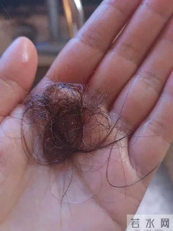 30+掉发快秃了？医生教的5个习惯+内调，发缝慢慢变窄