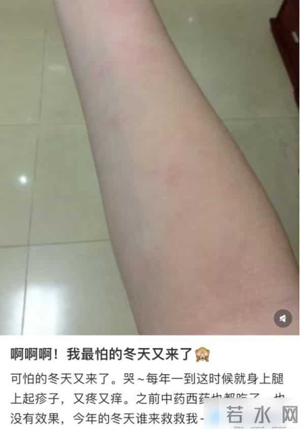 穿上之后痒成“峨眉山猴子”，今年秋冬爆款成最遭罪单品了