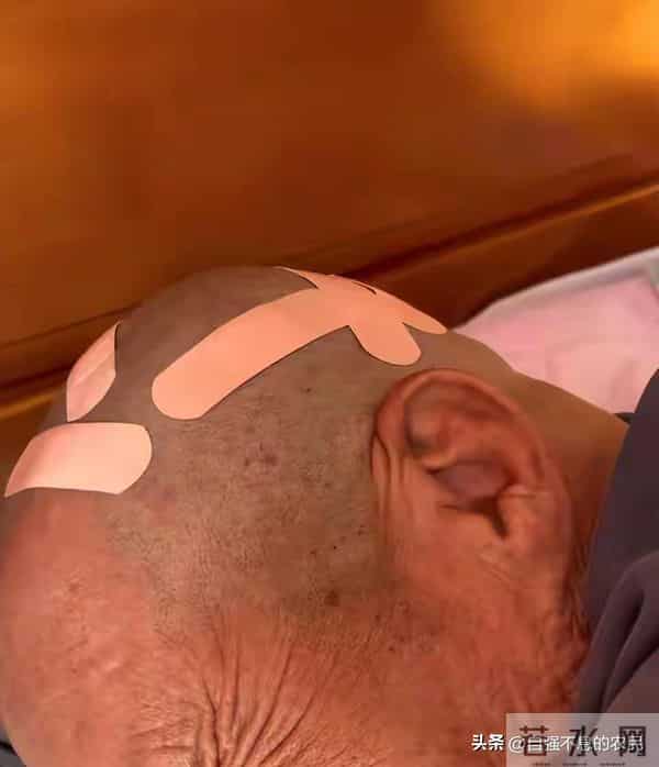 大爷花10元剃头后满头伤口不忍追责