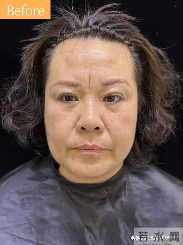 文眉师故意文丑眉强迫顾客升单获刑，纹眉背后的健康隐患：