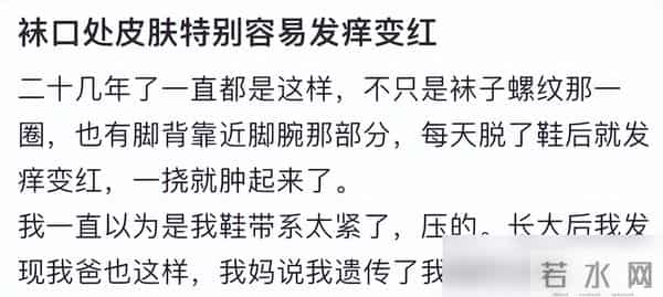 穿上之后痒成“峨眉山猴子”，今年秋冬爆款成最遭罪单品了