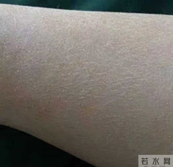 冬天裤脚全是白屑？别慌！身体乳+食疗双管齐下，皮肤嫩到掐出水