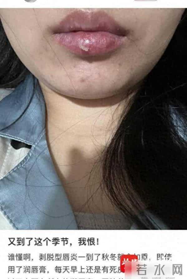 睡前涂润唇膏更有效？秋冬护唇：这两个坏习惯先改掉