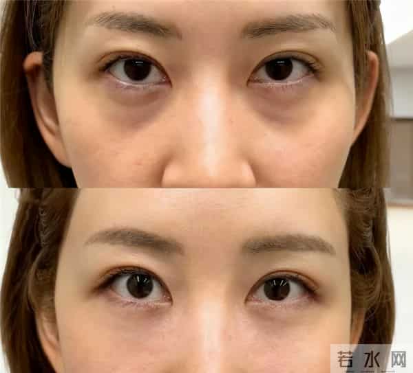 抗衰真相公开！去眼袋眼纹10款眼霜推荐！哪个品牌好？实测来袭