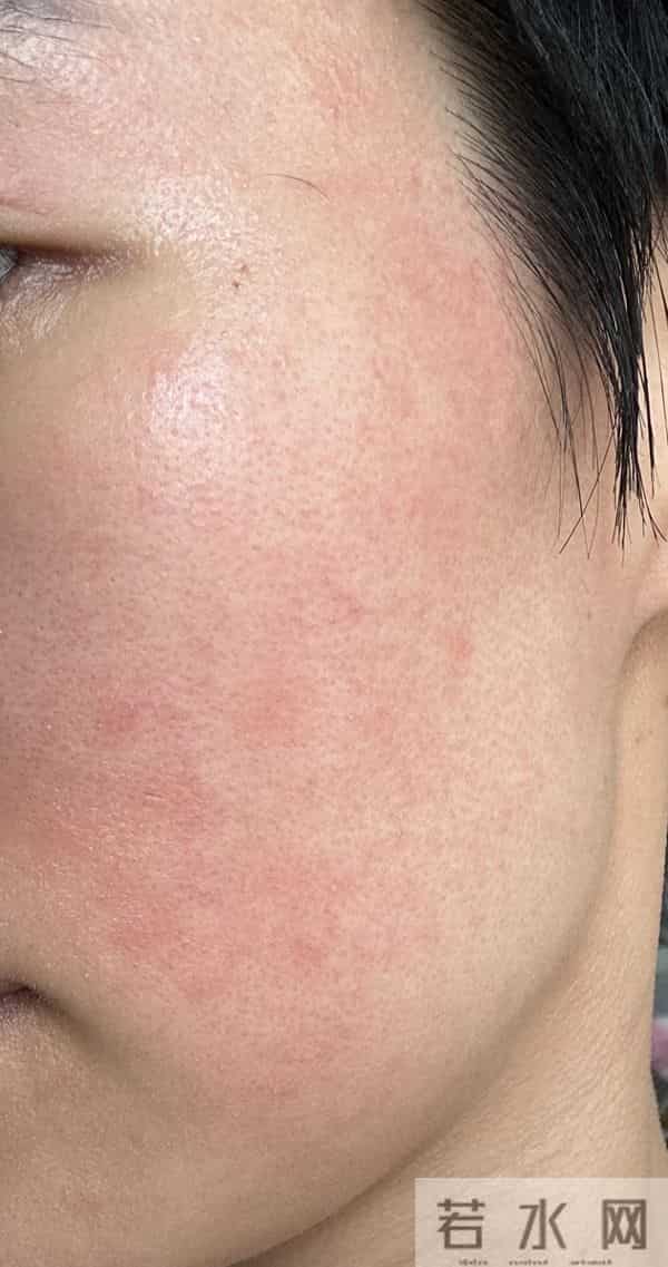 从平替到刺客，可复美一年涨158元，敏感肌的钱真好赚？