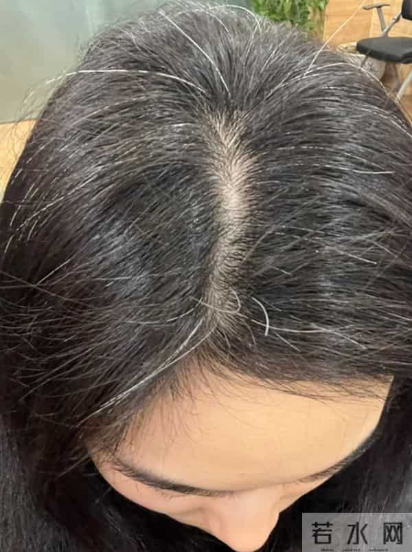 20多岁就长白发？别只怪遗传！3个“养黑”方法亲测有效。