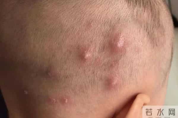 染发致癌是真的吗？哈佛大学调查11万人长达25年，结论终于出来了