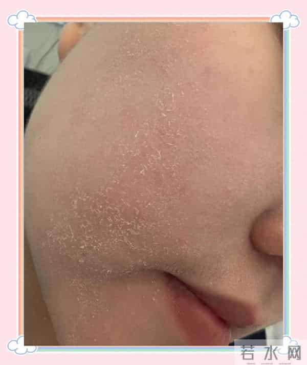 冬日保湿王炸组合！百雀羚+凡士林干皮亲测封神