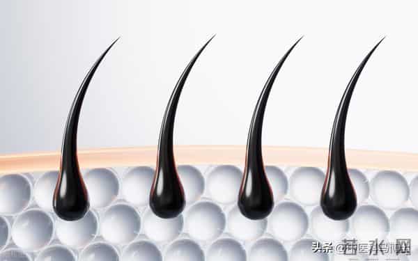 冬季头皮养护正当时 科学应对脂溢性脱发关键期