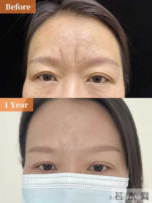 文眉师故意文丑眉强迫顾客升单获刑，纹眉背后的健康隐患：