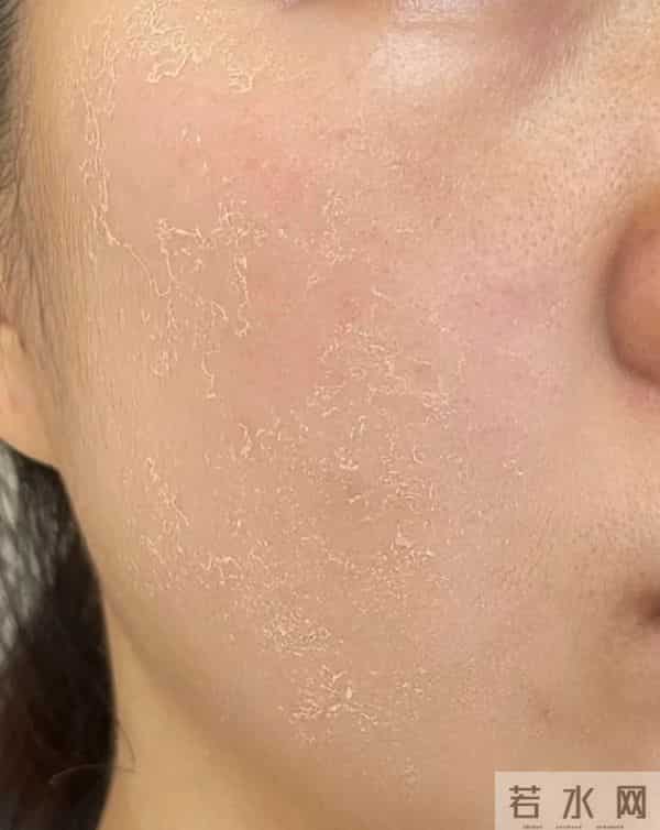 从平替到刺客，可复美一年涨158元，敏感肌的钱真好赚？