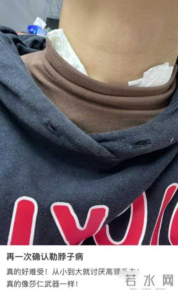 穿上之后痒成“峨眉山猴子”，今年秋冬爆款成最遭罪单品了