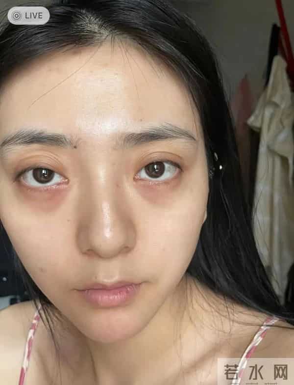 告别卡粉斑驳！保姆级遮瑕教程，手把手教你黑眼圈痘印全隐形