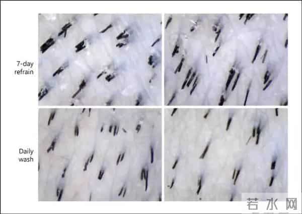 为什么我推荐大家每天洗头！每天