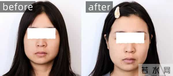 护肤的尽头是VC？