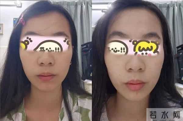 护肤的尽头是VC？