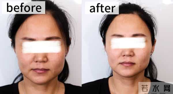 护肤的尽头是VC？