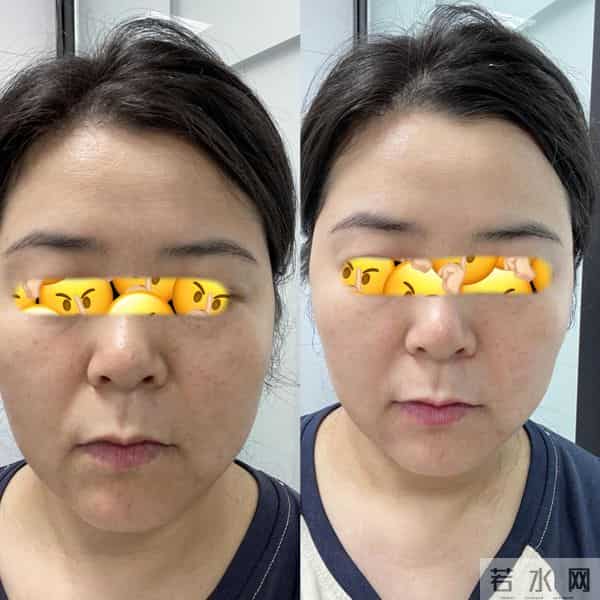 护肤的尽头是VC？