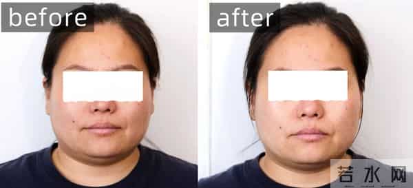 护肤的尽头是VC？