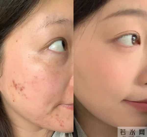 告别卡粉斑驳！保姆级遮瑕教程，手把手教你黑眼圈痘印全隐形