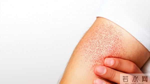 告别冬日“干”尬：一份全方位的冬季护肤指南