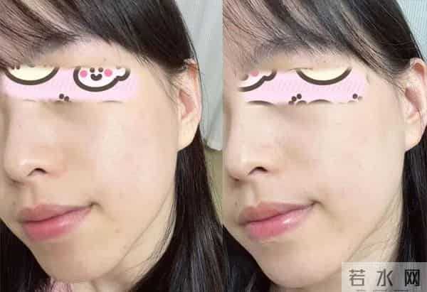 护肤的尽头是VC？