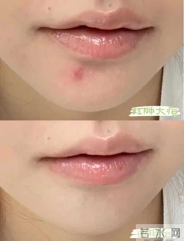 告别卡粉斑驳！保姆级遮瑕教程，手把手教你黑眼圈痘印全隐形