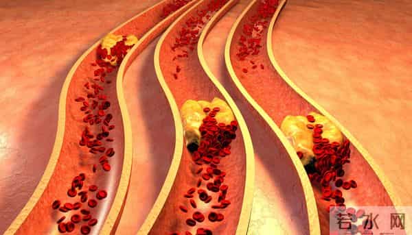 黄酒立大功！医生发现：常喝黄酒，或能降低5种并发症