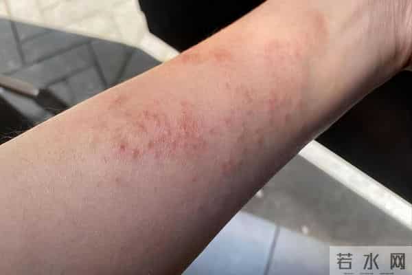 甲流升级，很多患者不发烧。出现以下症状，要注意了！