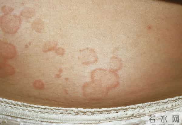 白血病越来越年轻化，医生再次告诫：这几样零食，千万别给孩子吃