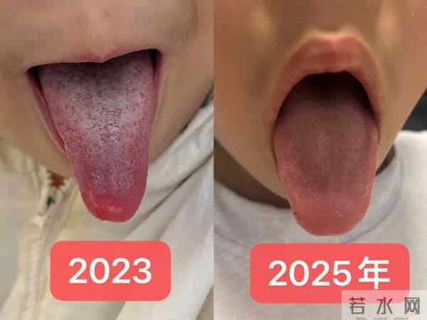 戒掉两样，孩子鼻子通了