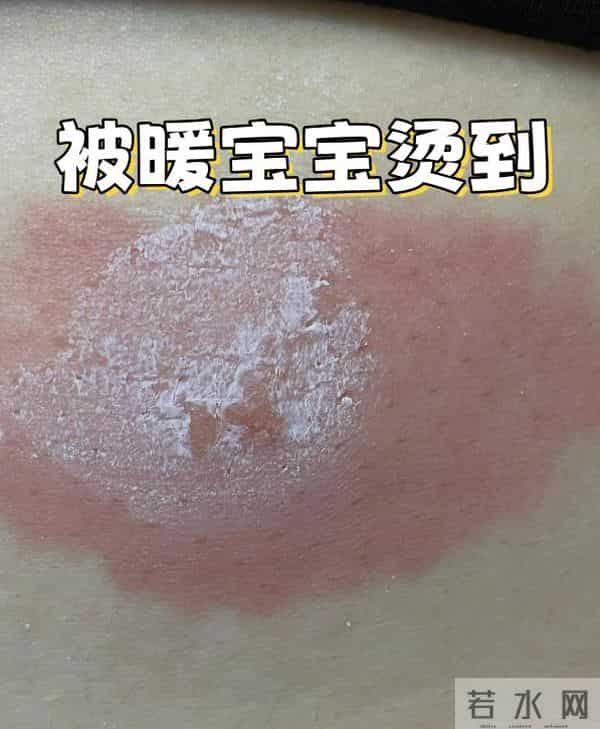 被央视拉黑的4样“取暖神器”，不管天气多冷，都不建议用！