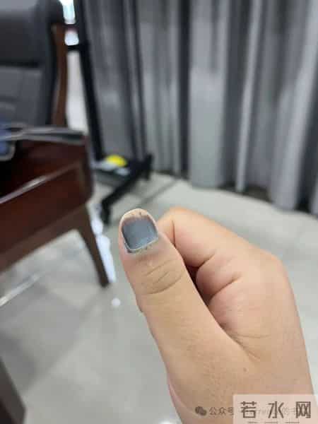 网友记录手指甲掉落的全过程