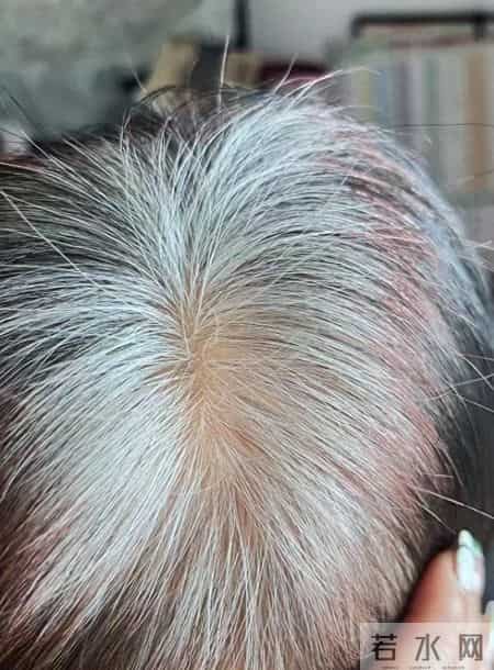 别再瞎补了！白发能不能变黑就看这一点