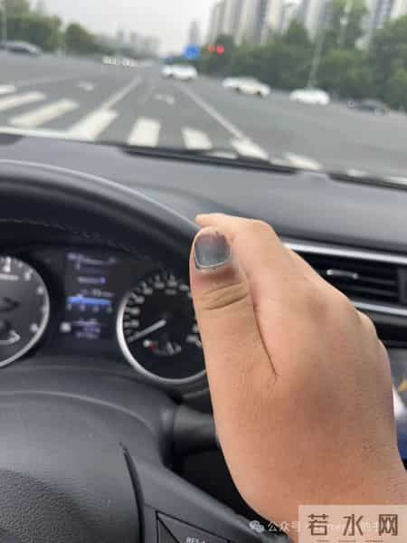 网友记录手指甲掉落的全过程