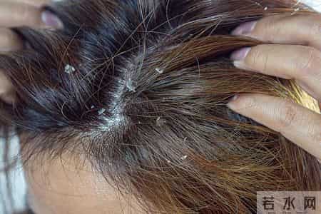有一名女子用硫磺皂洗头，坚持半年后，头皮出现了这6个变化