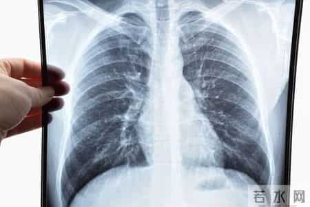 医生提醒：无论多坏的肺，只要常吃这5样，肺一天比一天好
