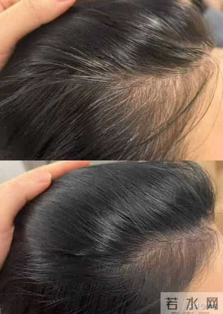 47岁阿姨!拒绝染发+朱雀三啄,半年养淡白发