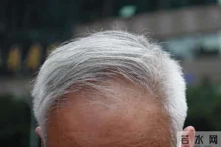 少白头、白发多?这些方法帮你自然养发