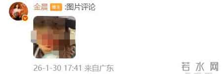 警方通报金晨驾车出事助理“顶包”一事,金晨晒受伤照片并道歉,喜之郎隐藏其代言信息后又恢复
