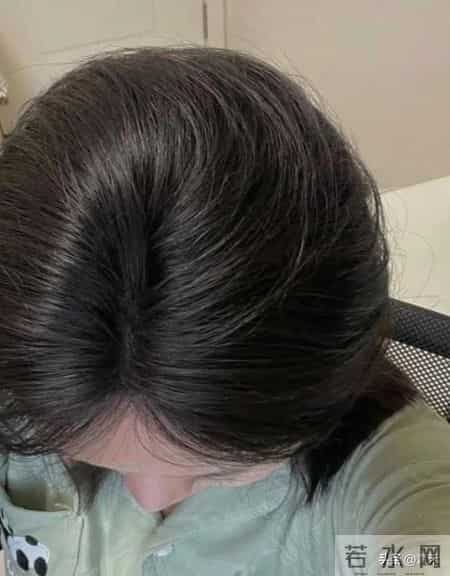 87年女生坚持朱雀三啄+每日黄芪水，九月养淡白发