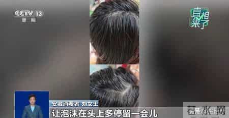白头发“一洗就能黑”？专家：白发无法逆转