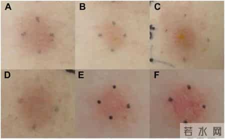 不建议你一过年就爱美甲的原因是:可能会影响补牙!