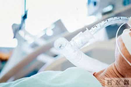 不拔管，百万赔偿就没了